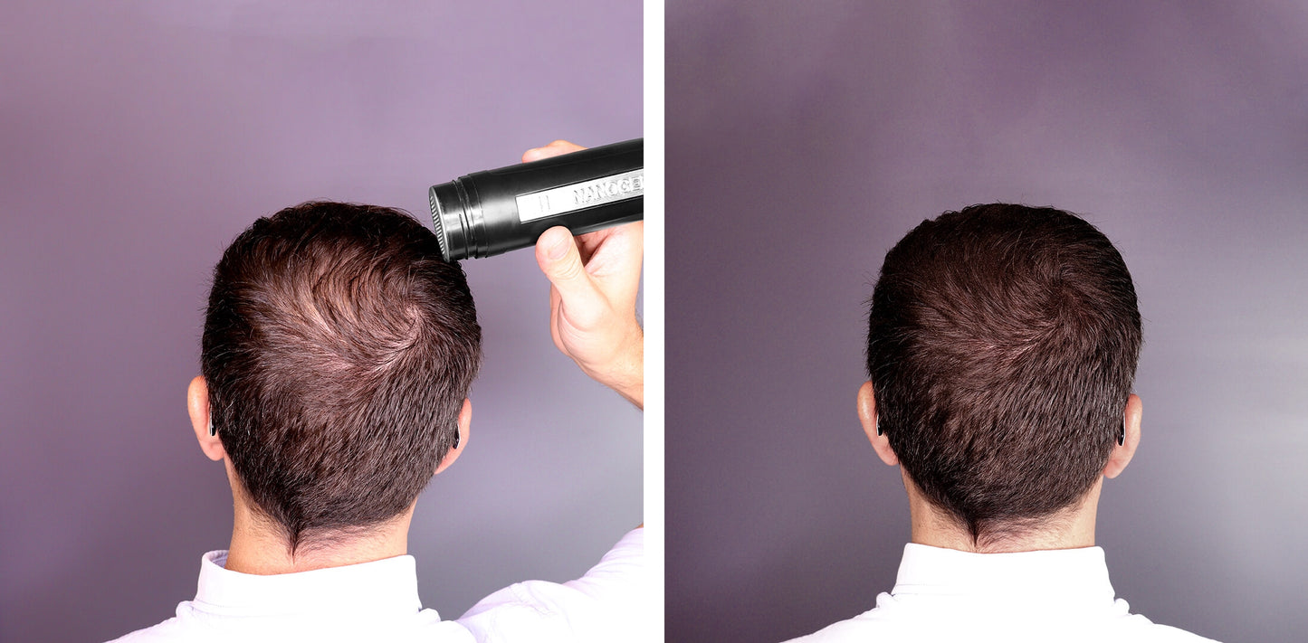 KIT TOPPIK X 3 – El secreto para un cabello con más densidad y confianza