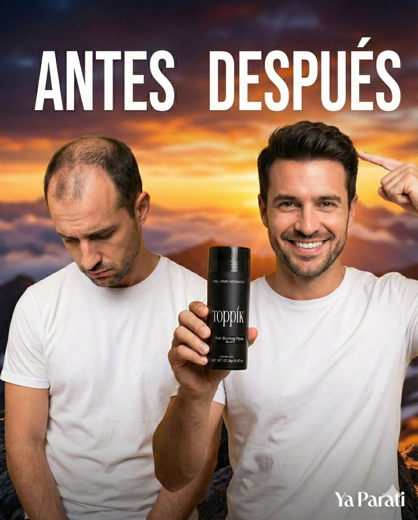 KIT TOPPIK X 3 – El secreto para un cabello con más densidad y confianza